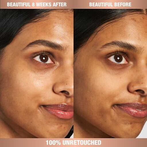 CHARLOTTE’S ULTIMATE MAGIC SKIN ROUTINE SKINCARE KIT